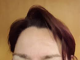 image of cowlick at hairline | The Best Ottawa Hair Salon?